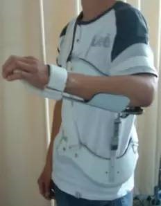 肩矫形器.png