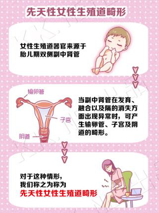 先天性女性生殖道畸形.png