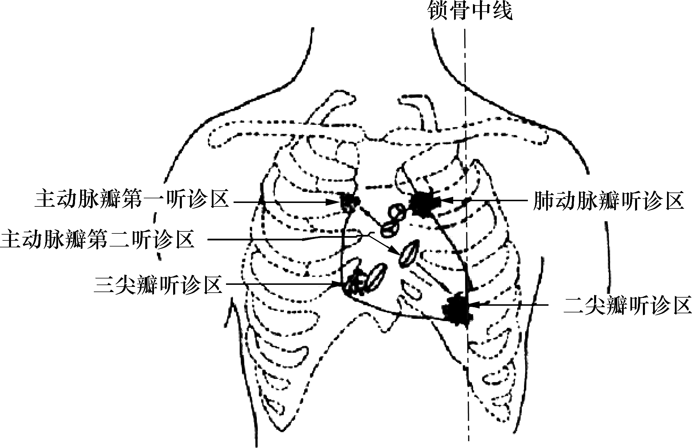 图4-14 心音听诊部位示意图