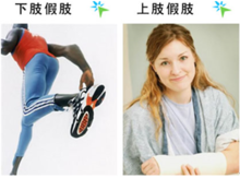 上下假肢.png
