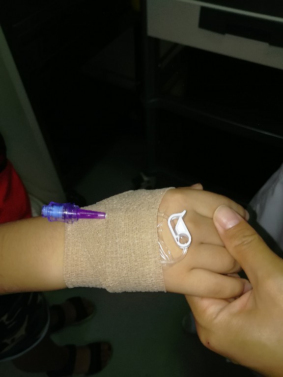 静脉留置针穿刺及固定