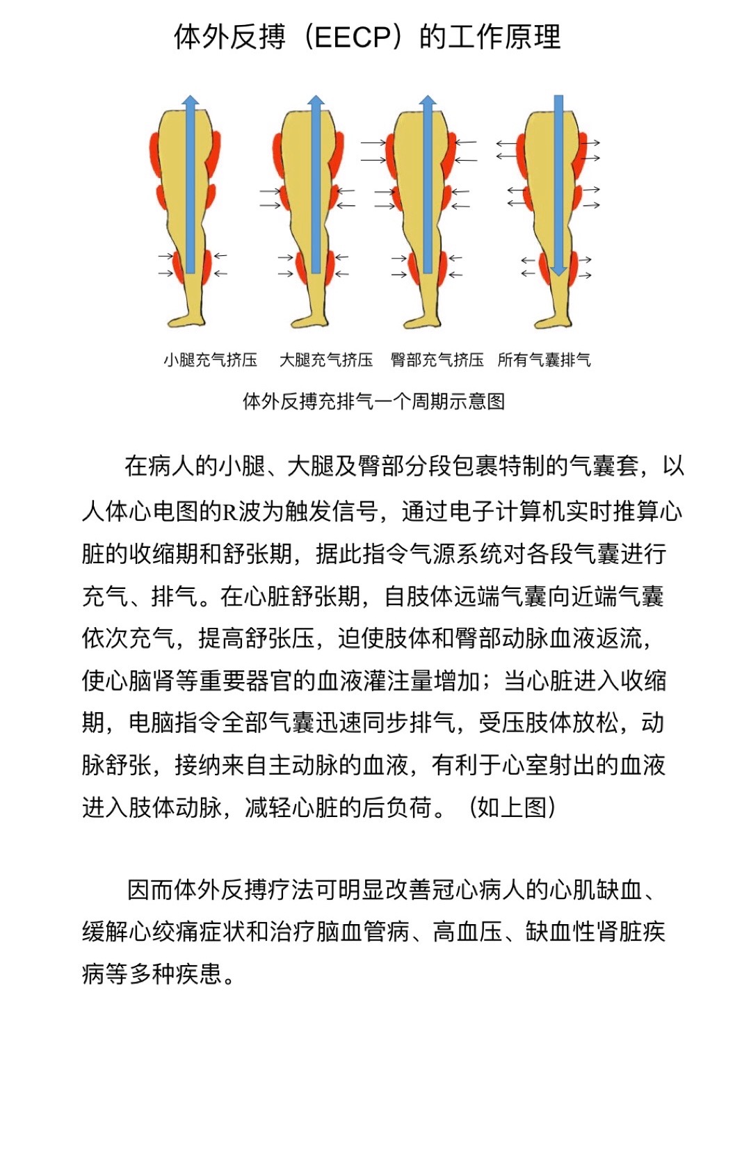 KF0704体外反搏的工作原理.JPG