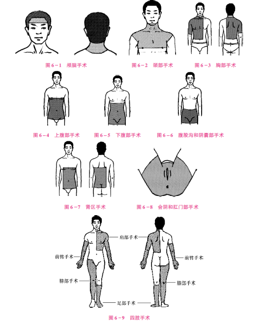 二,皮肤准备的方法注意事项:备皮操作中应注意避免皮肤损伤,以防细菌