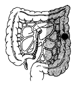 (1)结肠癌根治术:切除范围包括癌肿所在肠襻及其系膜和区域淋巴结.