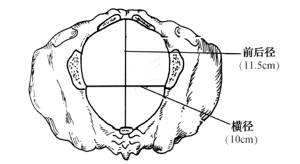 ②中骨盆平面(pelvic midplane):为骨盆最小平面,最狭窄.