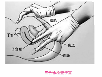 检查内容同双合诊和三合诊,适用于未婚和阴道闭锁不宜做双合诊者.