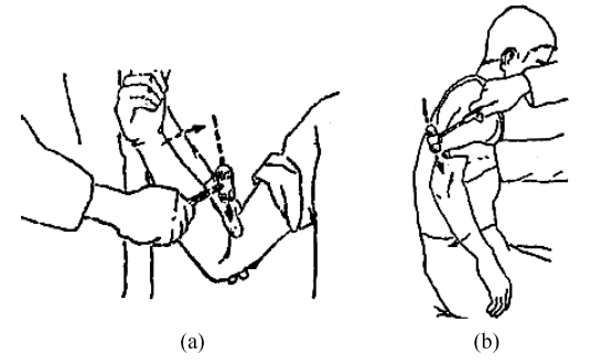 图10-18 肱二头肌和肱三头肌的检查方法4.