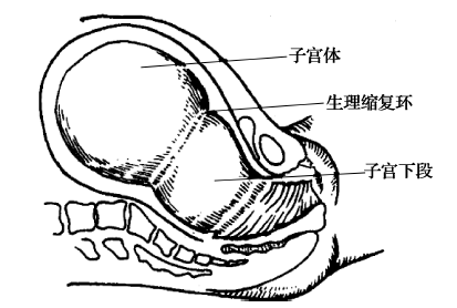 生理性缩复环(2)宫颈的变化:①宫颈管消失:临产前宫颈管长2～3cm,初